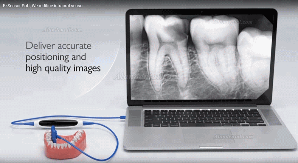 VATECH EZSensor Soft Type Dental X Ray Sensor